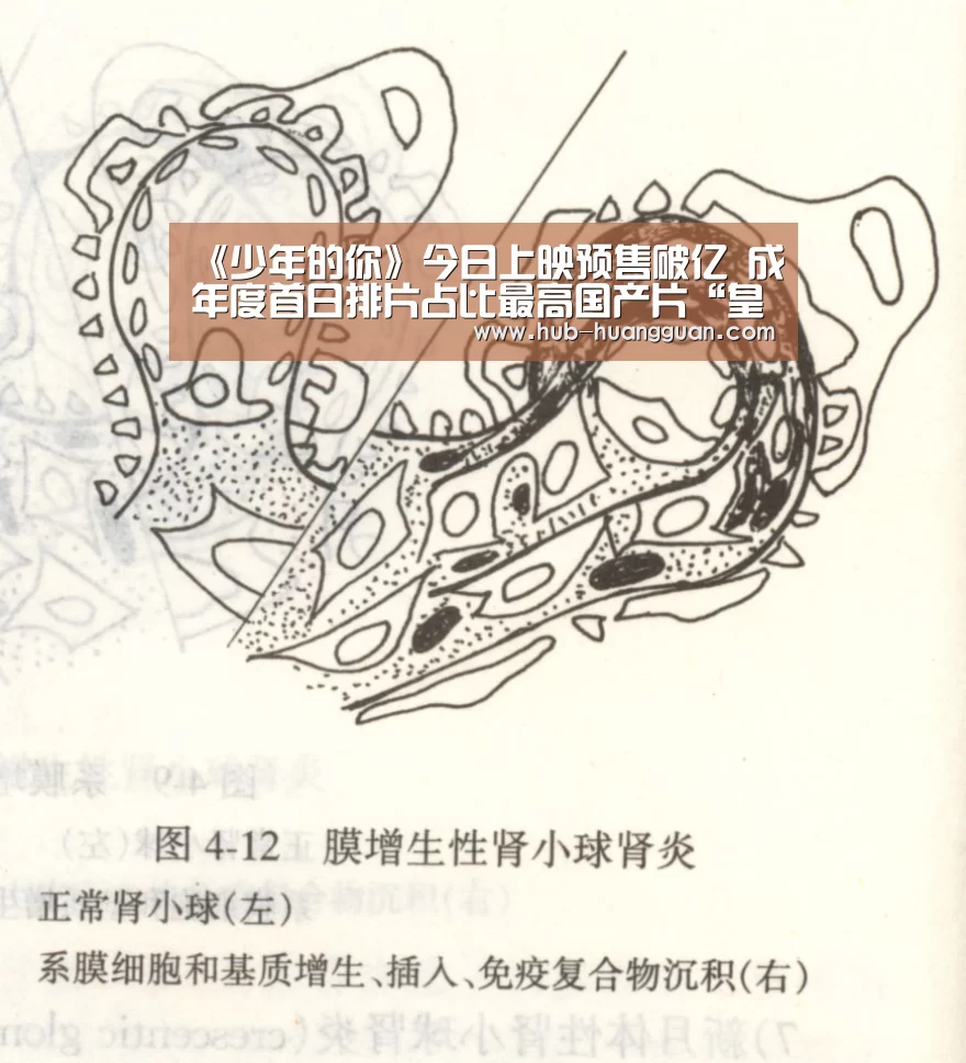 《少年的你》今日上映预售破亿  成年度首日排片占比最高国产片“皇冠体育官网”